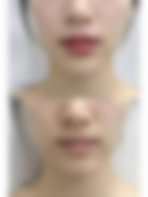 临床实例分享