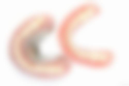 临床实例分享