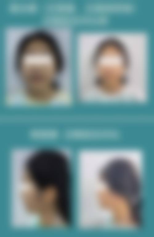 山东济南天桥区牙博士口腔预约挂号方式。
