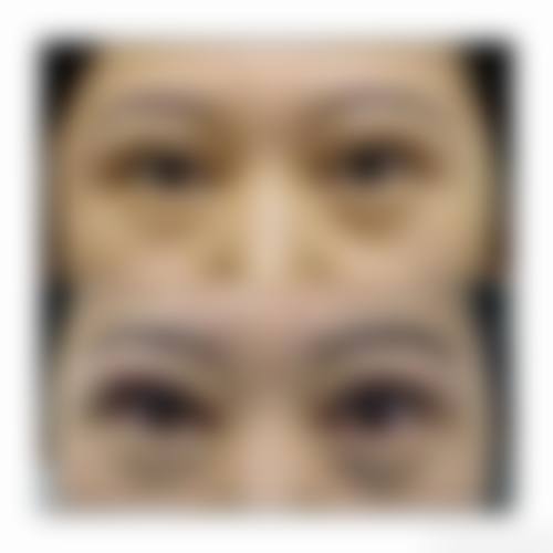 航空总医院眼科擅长项目。