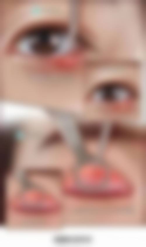 南阳南石眼科医院治疗反馈与口碑评价。