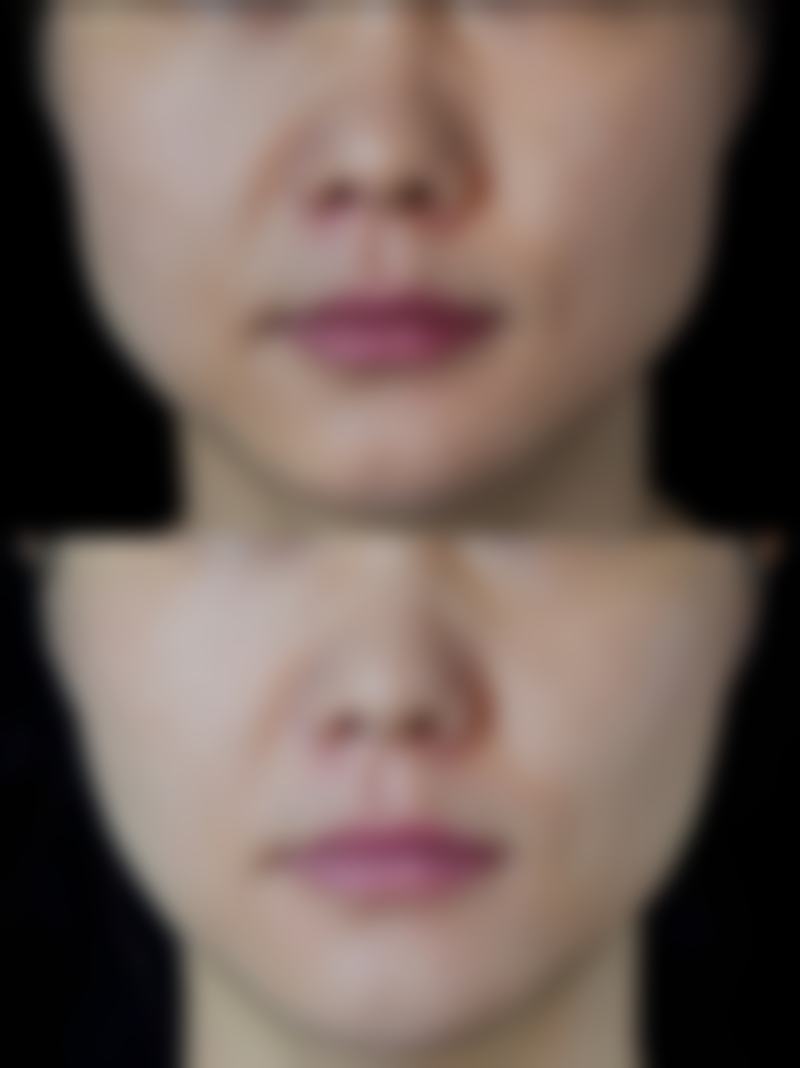 展金波医生在激光美肤与面部年轻化方面有哪些擅长项目？