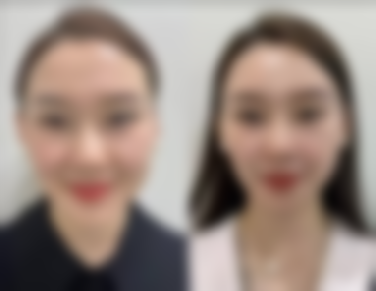 在内蒙古赤峰盛禧医疗美容门诊部，展金波医生的项目收费价格参考（2026年）