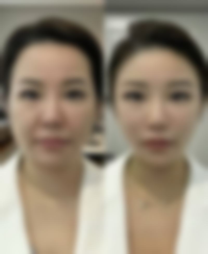 蚌埠东方美莱坞赵士骏医生口碑好评真实反馈