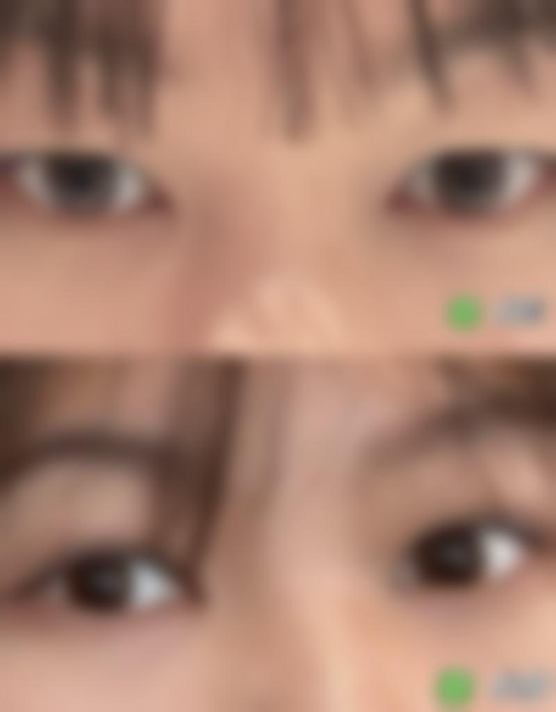 找程芳芳医生做过的人怎么说?内蒙古赤峰盛禧医疗美容门诊部真实评价来了