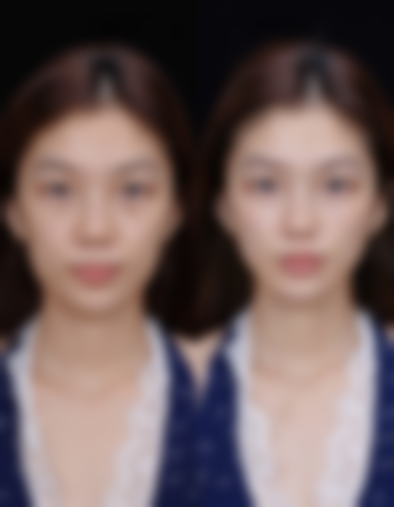2026年内蒙古赤峰盛禧医疗美容门诊部程芳芳医生项目收费参考