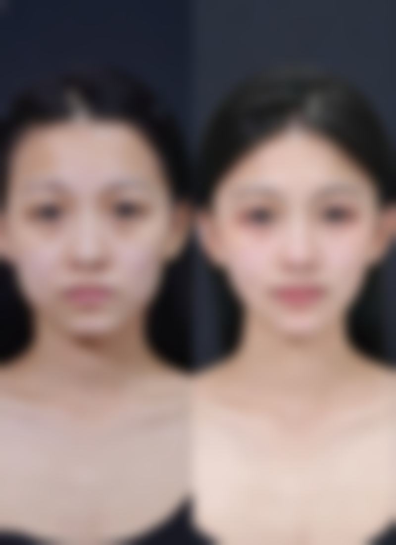快问快答：关于展金波医生与皮肤美容的常见问题