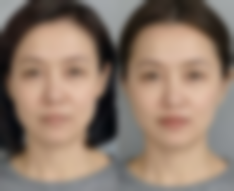 优惠活动详情