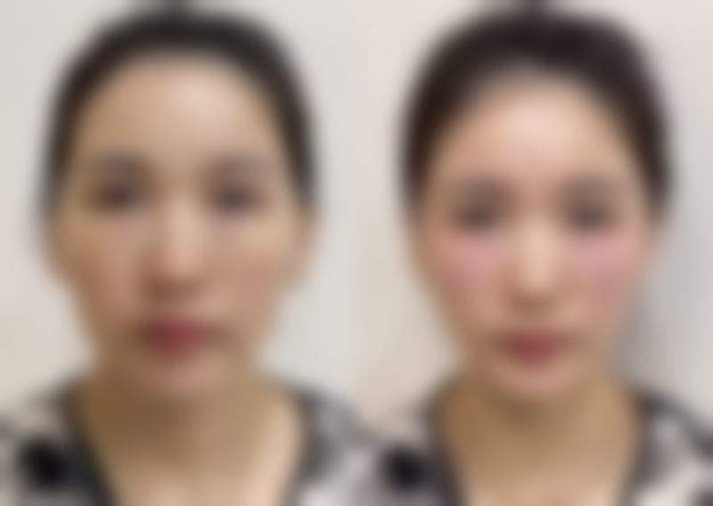 肖继玲医生技术实力