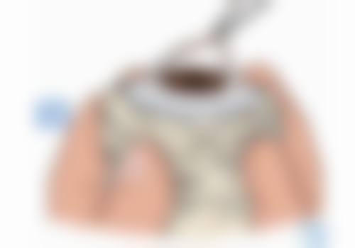 快问快答：关于无锡市精神卫生中 心眼动检查眼科的常见问题