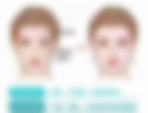 韩国Onecell皮肤科擅长项目