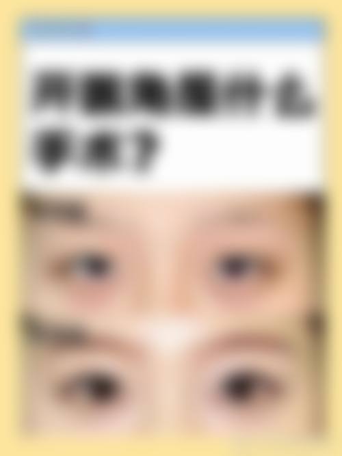 临床实例分享