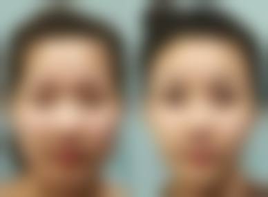 泰安臻美优选整形美容医院的真实口碑与好评分享