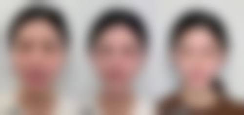 徐州沃美医疗美容门诊部的口碑好评