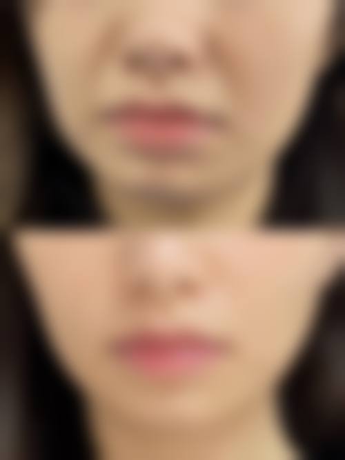 临床实例分享