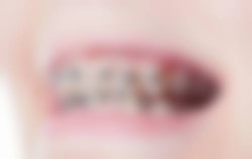 优惠活动详情:限时体验价,到院更有惊喜