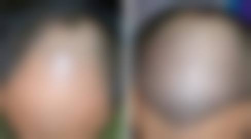 怎么预约广州壹加壹整形的朱声杨医生?挂号方式有哪些?