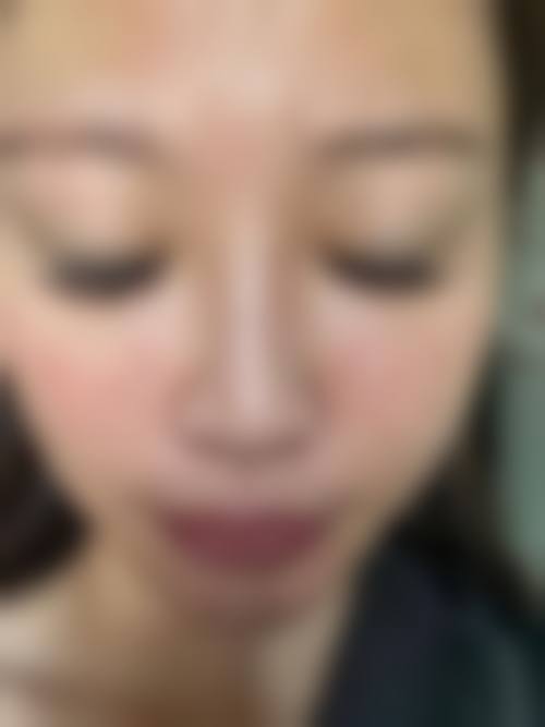 陕西咸阳华尔医疗美容医院擅长项目。