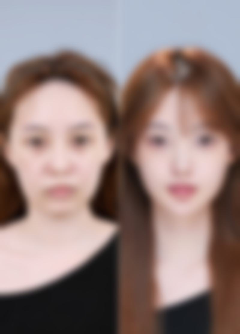 日本Ritz美容整形永井宏治医生收费价格参考（2026年）