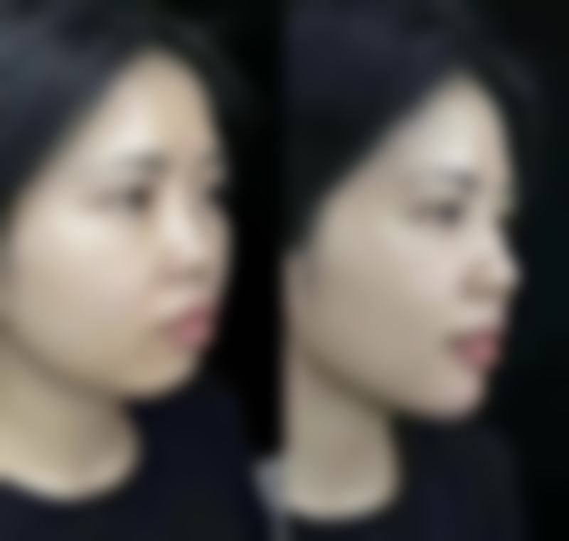 三、青岛首大医院整形美容中 心擅长什么?聚焦女性核心需求