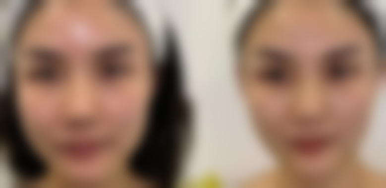 4. 广州轻伊美晶肤医疗美容诊所的口碑怎么样?听听体验过的人怎么说