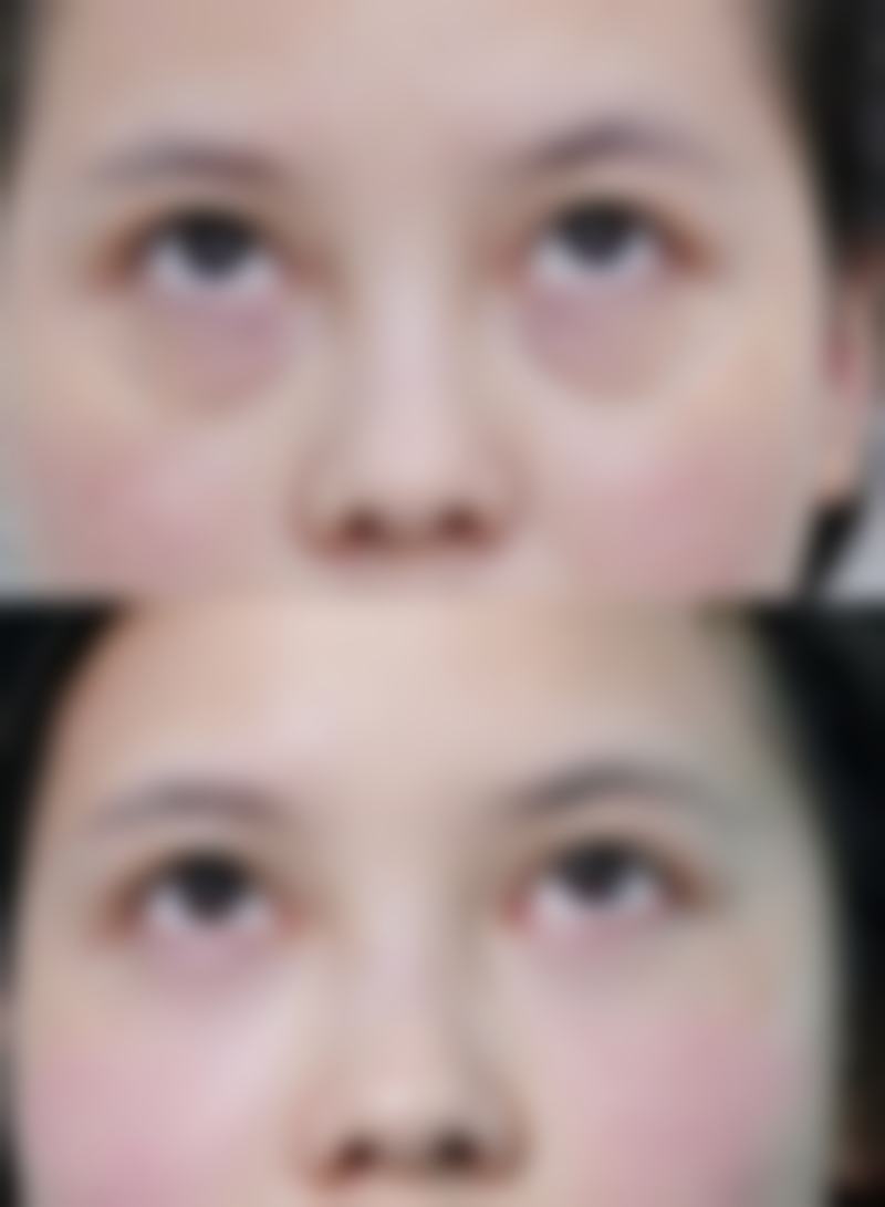 关于泰安臻美优选整形美容医院的常见问答(快问快答)